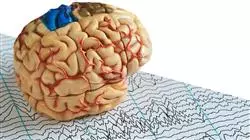 practicas externas fisioterapia abordaje dano cerebral adquirido