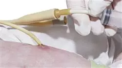 ##IMAGE##