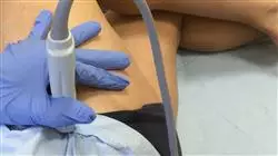 ##IMAGE##