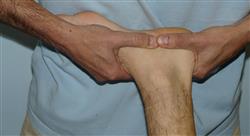 experto ecografía musculoesquelética en fisioterapia de pie y tobillo