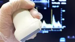 ##IMAGE##