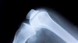 diplomado online fisioterapia