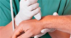 posgrado ecografía de mano en fisioterapia
