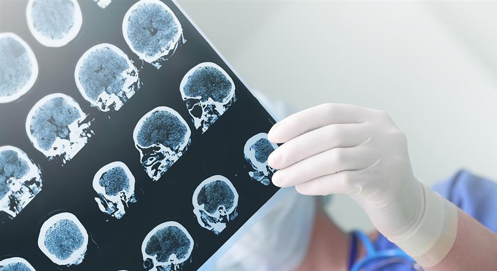 estudiar abordaje fisioterápico del daño cerebral adquirido en pediatría