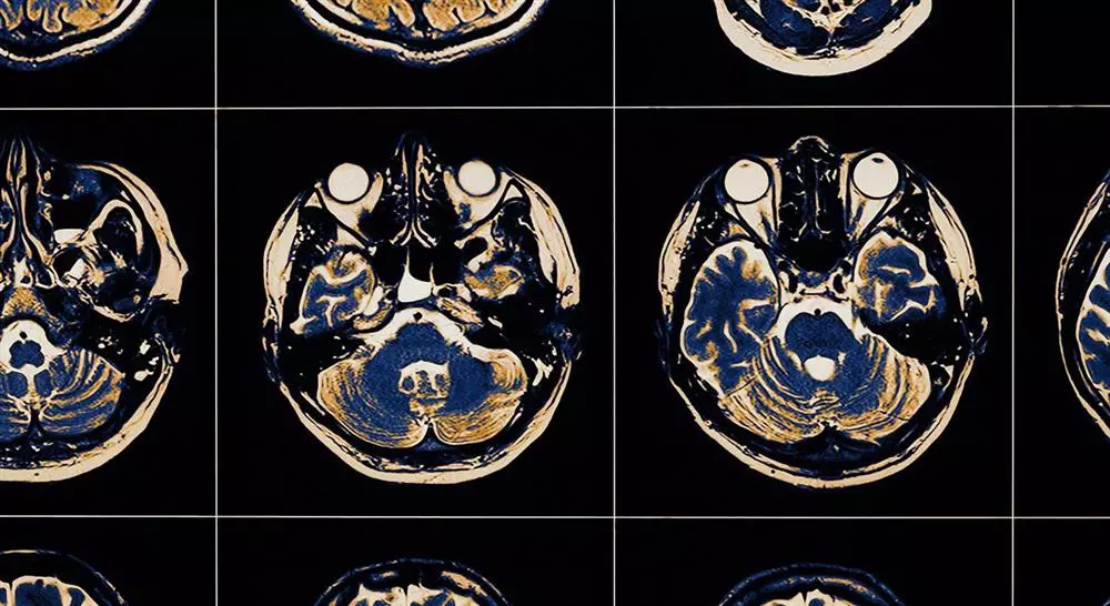 posgrado abordaje de las complicaciones en el daño cerebral adquirido para fisioterapia