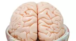 diplomado online abordaje de las complicaciones en el daño cerebral adquirido para fisioterapia