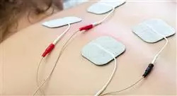 curso online aplicación invasiva de la corriente en fisioterapia
