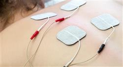 curso estimulación eléctrica transcutánea en fisioterapia