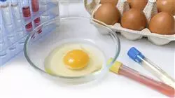 ##IMAGE##