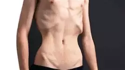 ##IMAGE##