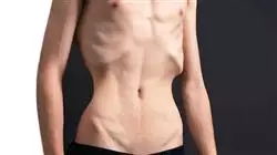 ##IMAGE##