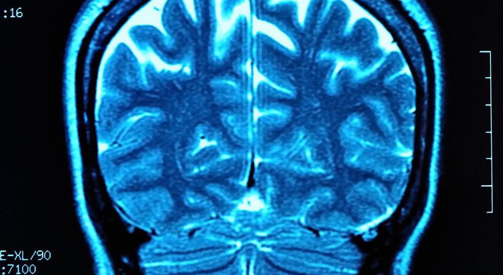 formacion neuroanatomía y trastornos mentales