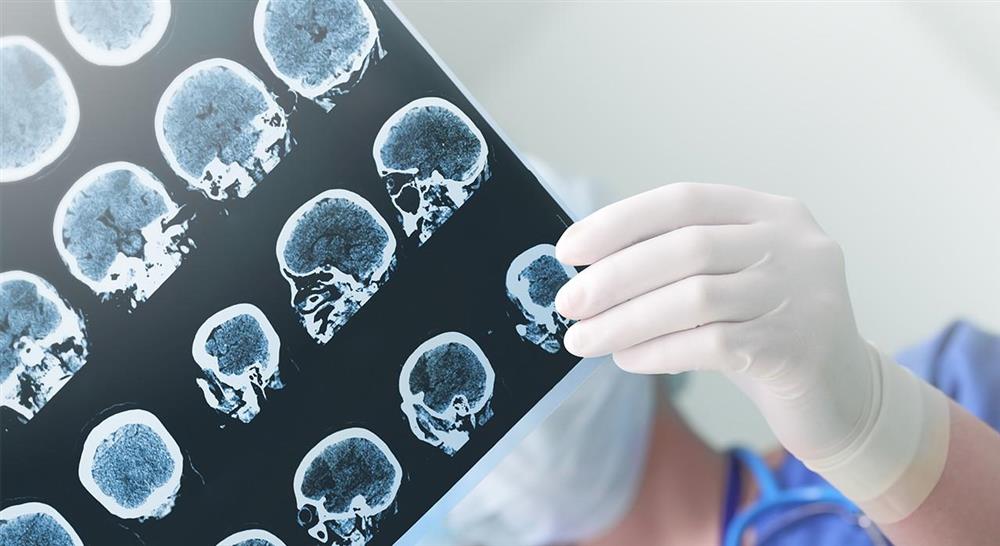 posgrado neuroanatomía y trastornos mentales
