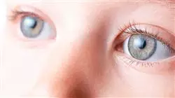 ##IMAGE##