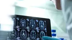 diplomado online principios neuroanatomia