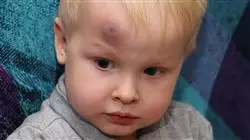 ##IMAGE##