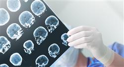especializacion neuroanatomía de los trastornos mentales