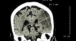 especializacion online neuroanatomía de los trastornos mentales