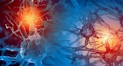 experto neuroanatomia trastornos Tech Universidad