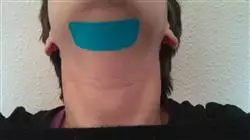 ##IMAGE##