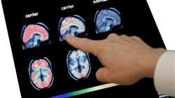 formacion bases neuroanatomia funcional