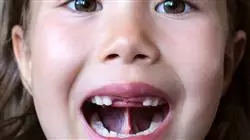 ##IMAGE##