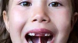 ##IMAGE##