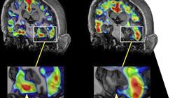 magister neuropsicologia clinica
