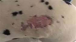 ##IMAGE##
