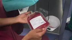 ##IMAGE##