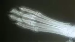 ##IMAGE##