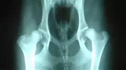 ##IMAGE##