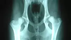 ##IMAGE##