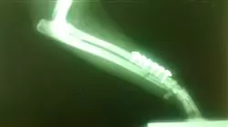 ##IMAGE##