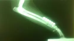 ##IMAGE##