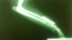 ##IMAGE##