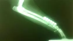 ##IMAGE##