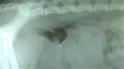 ##IMAGE##