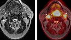 experto universitario neurocirugianeurocirugia de pequenos animales f