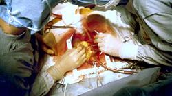 especializacion medicina cardiorrespiratoria