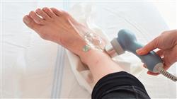 diplomado ultrasonoterapia laser actividad fisica deporte