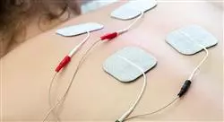 curso estimulación eléctrica transcutánea en medicina rehabilitadora