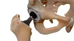 ##IMAGE##