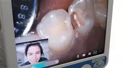 ##IMAGE##