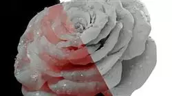 ##IMAGE##