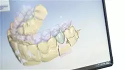 ##IMAGE##