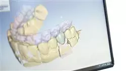 ##IMAGE##