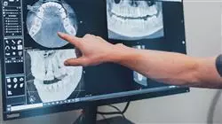 ##IMAGE##