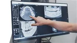 posgrado aspectos eticos inteligencia artificial odontologia
