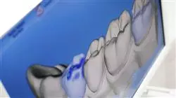 ##IMAGE##